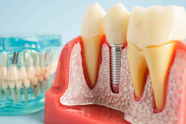 Professional Dental Services in North Bennington, VT